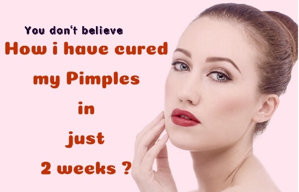 Pimples zaivoo